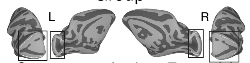 Group-average macaque left and right hemispheres with the V1 surface regions boxed